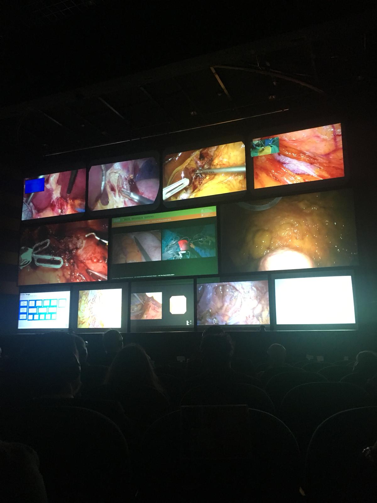 Chirurgia, il robot da Vinci in diretta streaming con oltre 2000 chirurghi di tutto il mondo